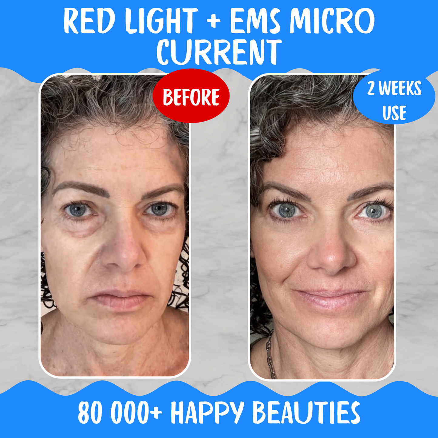 Redlyne Eye Recovery Bundle